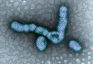 káros trendek | kép H1N1 vírus mikroszkóp alatt
