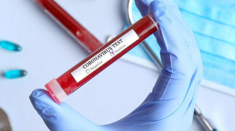 Megbízhatatlanok a PCR tesztek, a karantén pedig jogellenes