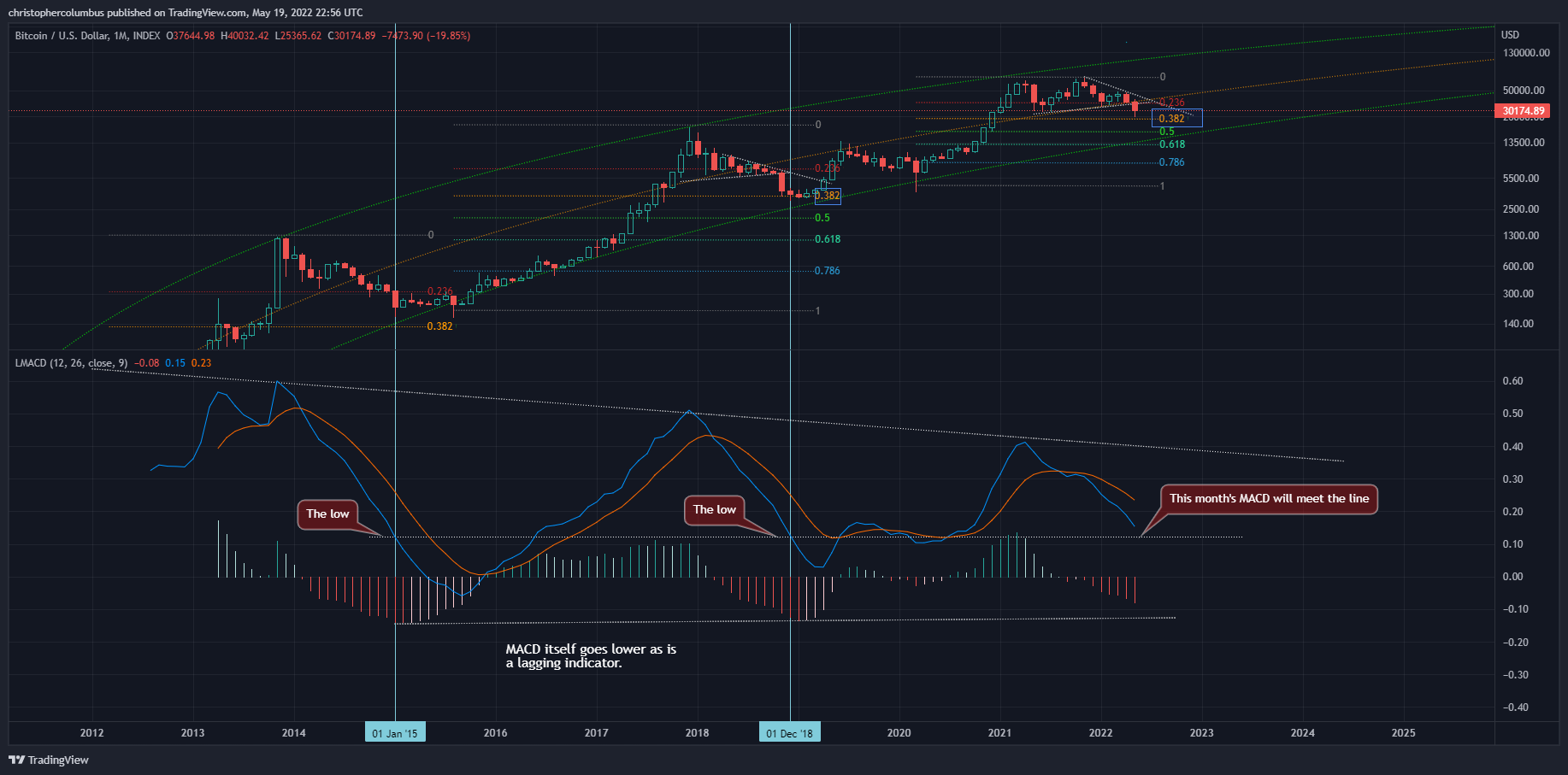 MACD