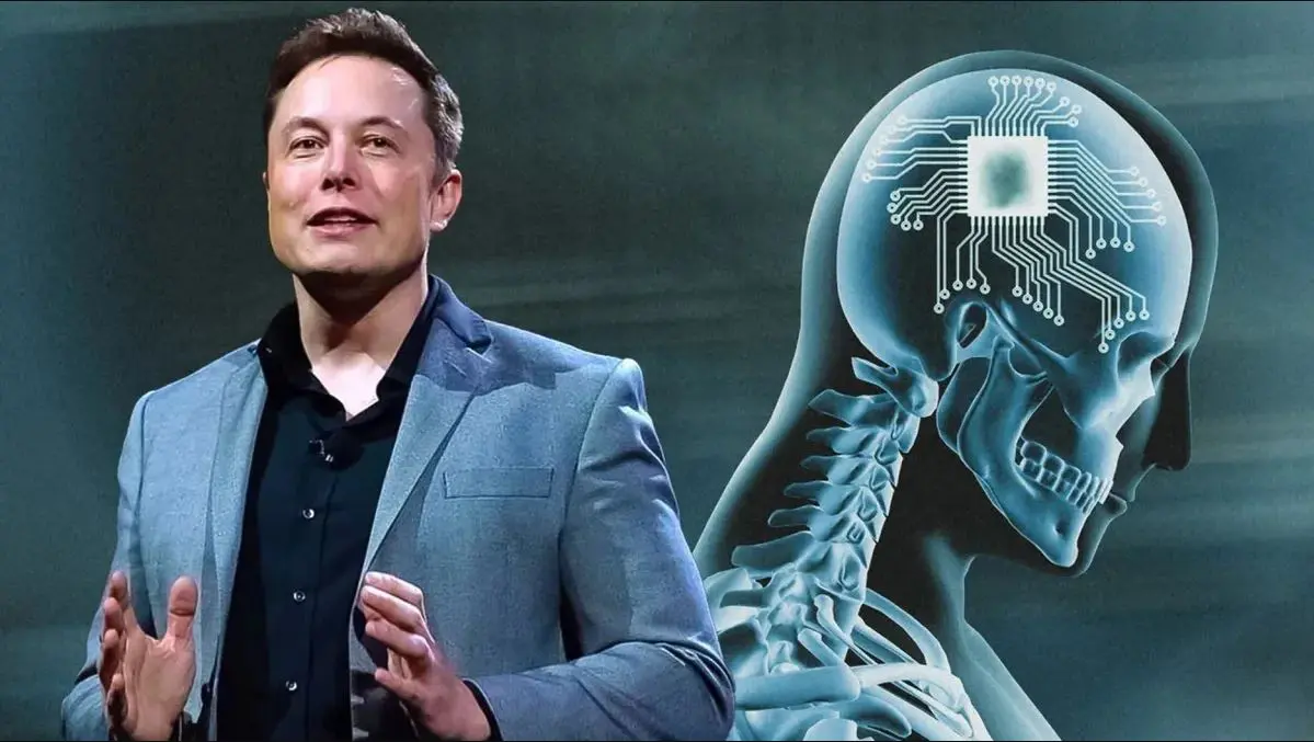Elon Musk mikrochipje